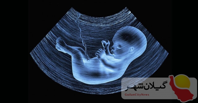 مجلس با اجباری شدن غربالگری در دوران بارداری مخالفت کرد