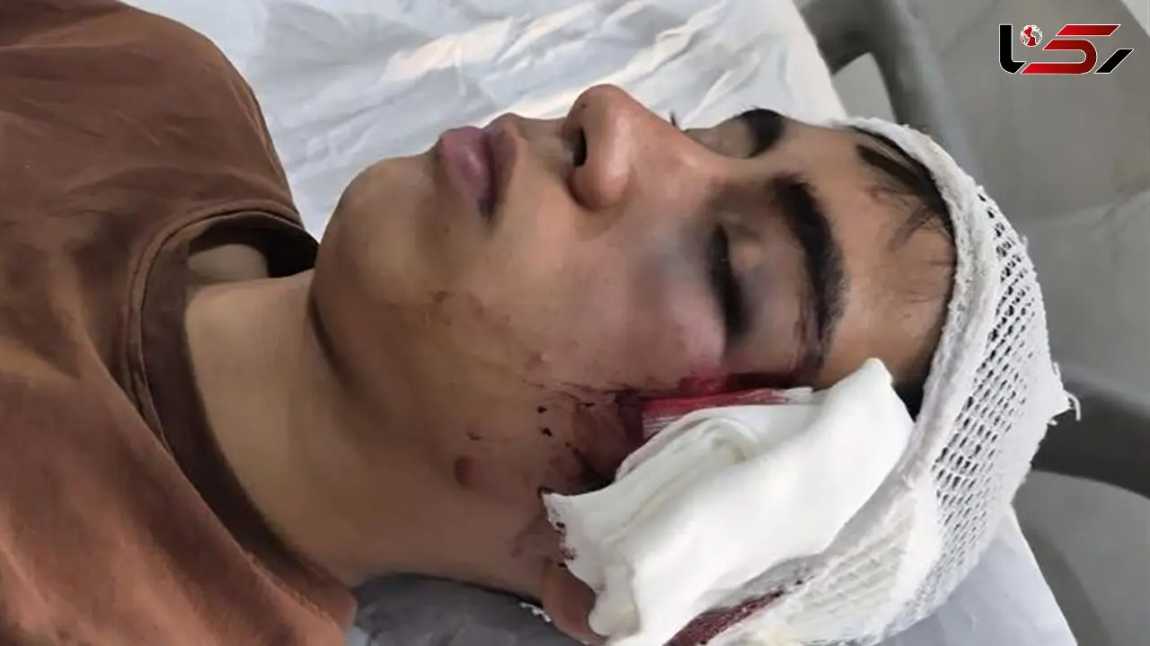 معلمی که با دسته صندلی به دانش آموز حمله کرده بود تعلیق شد / ورود دادستان بم به پرونده